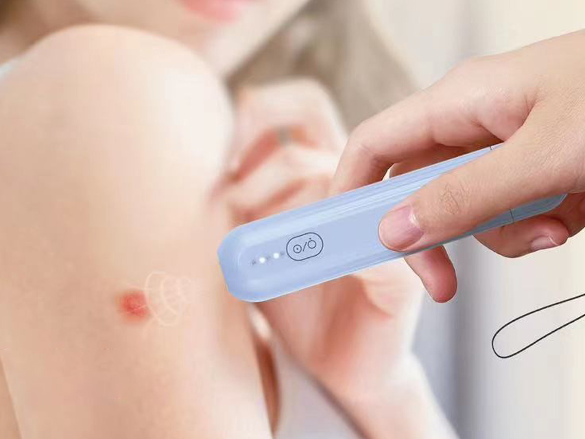 RIMEDIO PER PUNTURE DI INSETTI