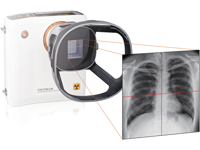 CAMERA A RAGGI-X PORTATILE REMEX KA6 con collimatore